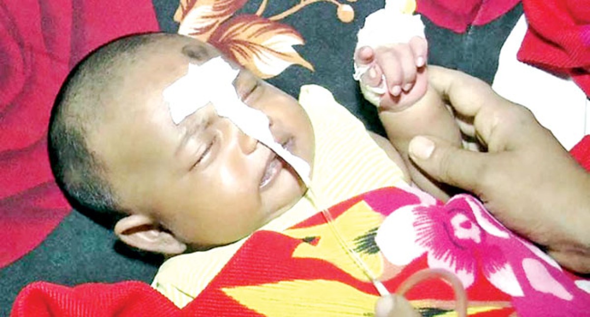 বায়ুদূষণে সবচেয়ে বেশি ক্ষতিগ্রস্ত হচ্ছে শিশুরা